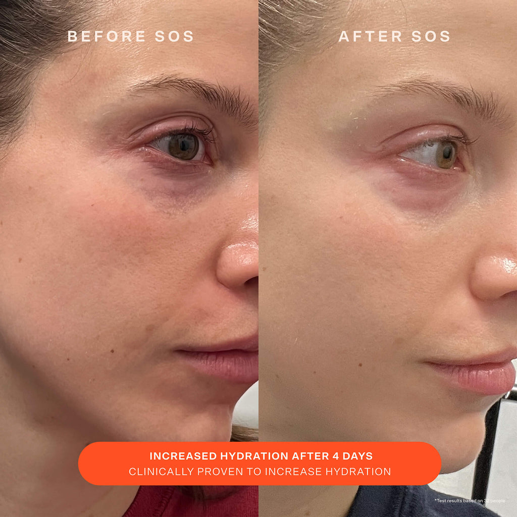 SOS Recovery Cream